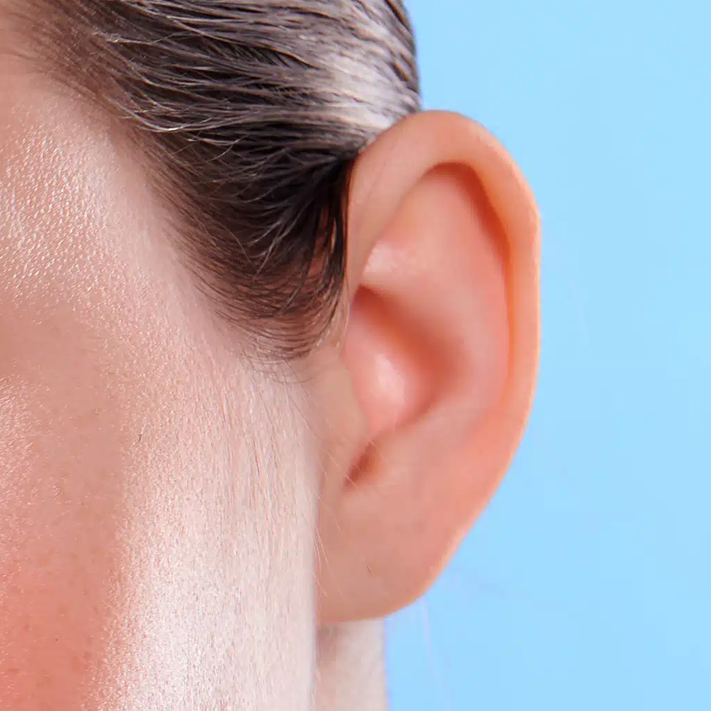 orejas otoplastia cirugia plastica estetica joaquim suñol barcelona