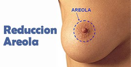 reduccion areola cirugia estetica barcelona